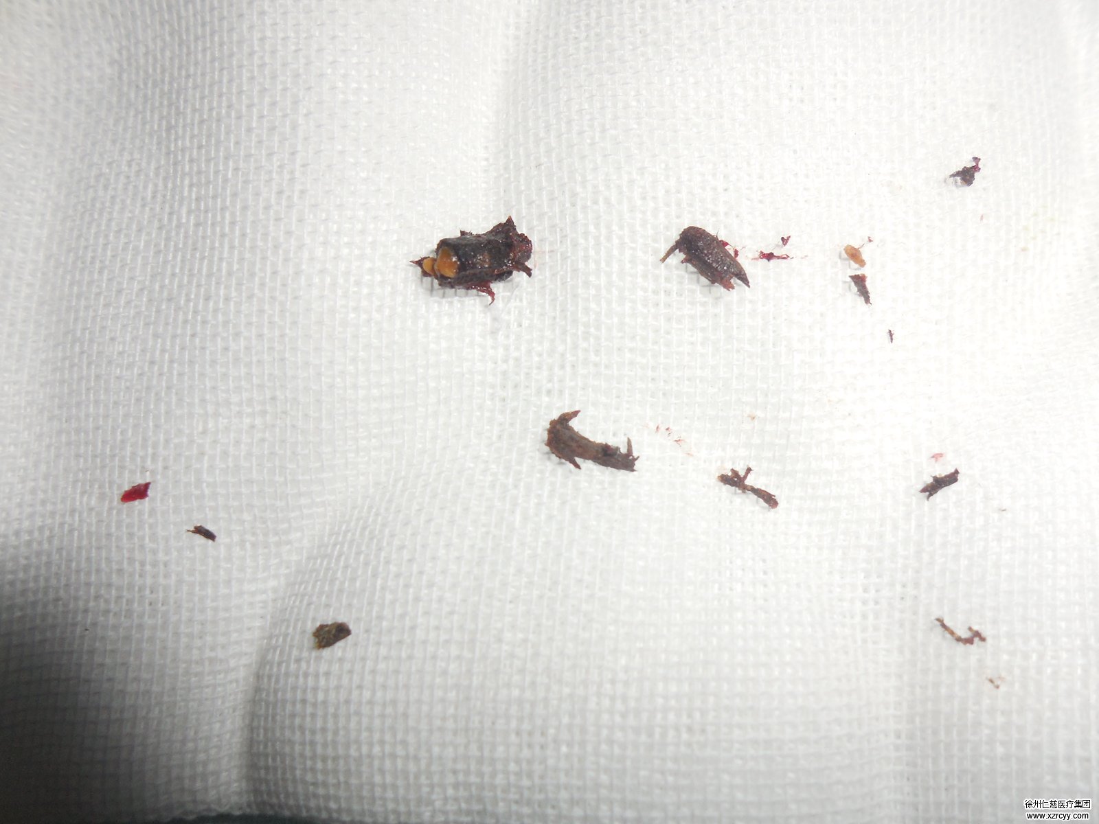 农民刨地竟刨出手榴弹炸断手指 被送往betway在线登陆救治