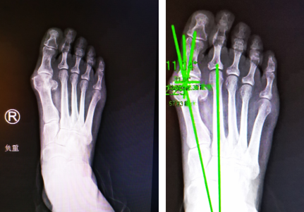 betway在线登陆足踝科