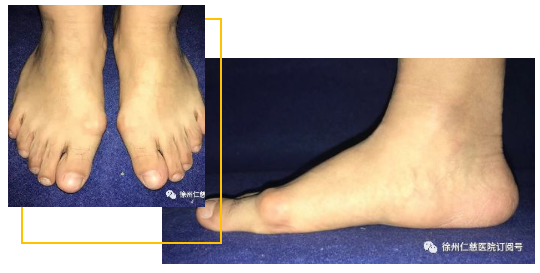 betway在线登陆足踝