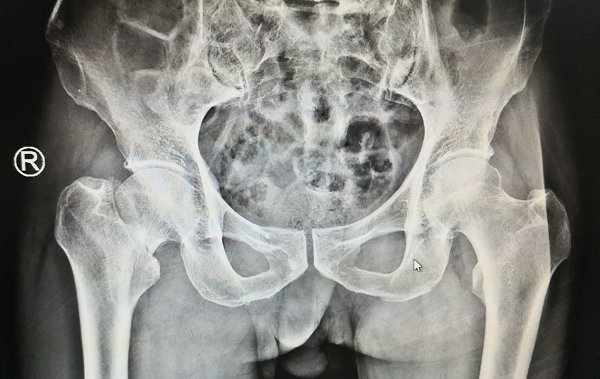 徐州sararz关节科