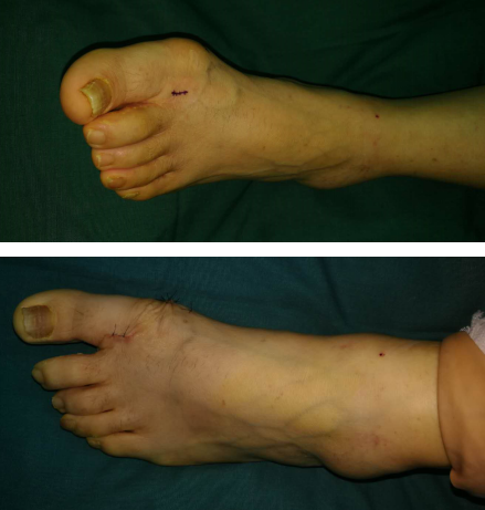 betway在线登陆足踝科