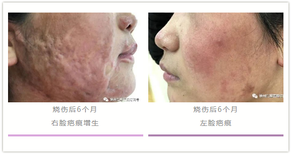 <a href='http://www.xzrcym.com/' target='_blank'><u>sararz医美</u></a>