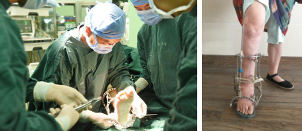 betway在线登陆创伤骨科