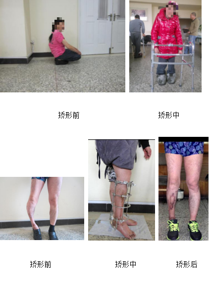 betway在线登陆创伤骨科