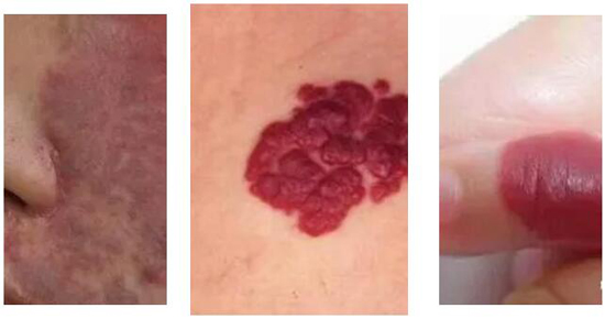 <a href='http://www.xzrcym.com/' target='_blank'><u>sararz医美</u></a>