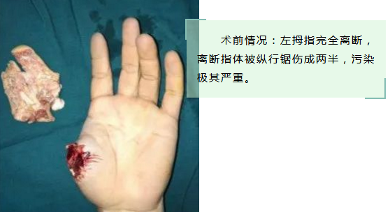 betway在线登陆手外科