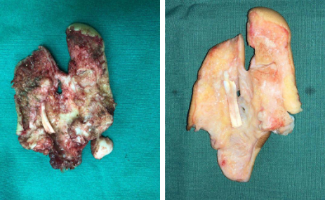 betway在线登陆手外科