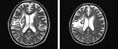 <a href='http://www.sararz.com/' target='_blank'><u>betway在线登陆</u></a>康复科