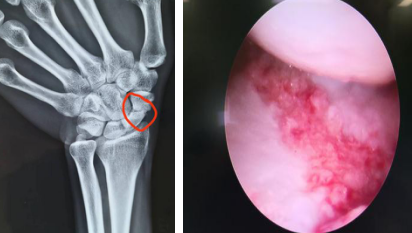 天玑骨科机器人