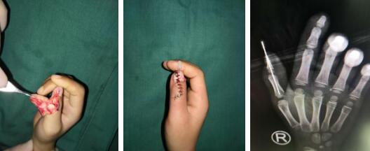 betway在线登陆手外科