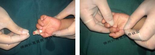 <a href='http://www.sararz.com/' target='_blank'><u>betway在线登陆</u></a>超级显微外科