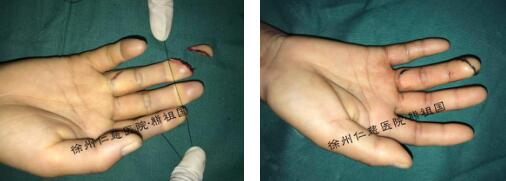 betway在线登陆超级显微外科