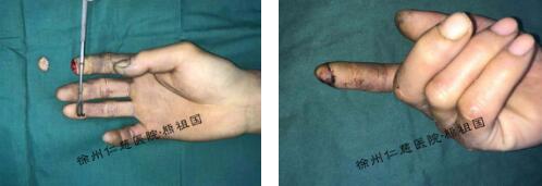 betway在线登陆超级显微外科