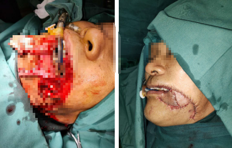 必威官方首页官网betway超显微外科