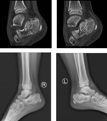 <a href='http://www.sararz.com/' target='_blank'><u>betway在线登陆</u></a>足踝科