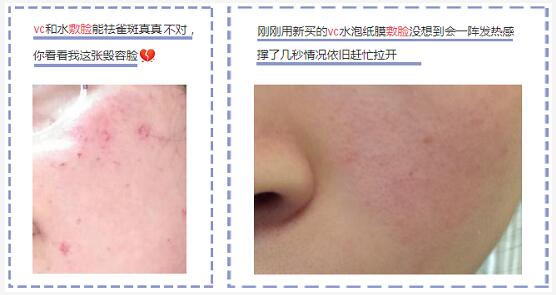 维C敷脸
