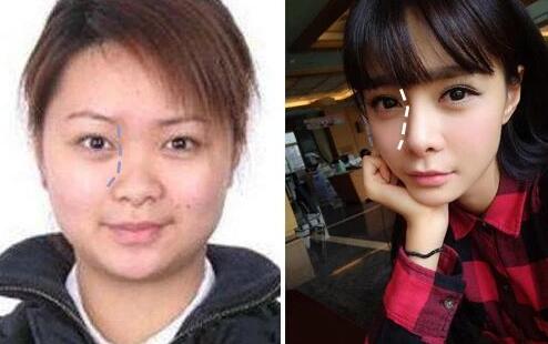 最先变化的是脸型。