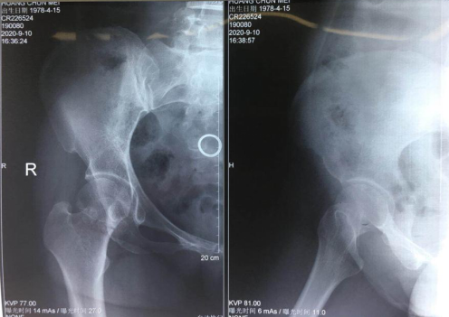 必威官方首页官网betway骨科机器人