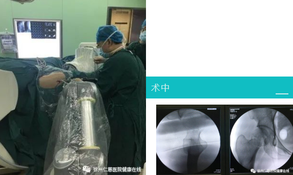 sararz骨科机器人