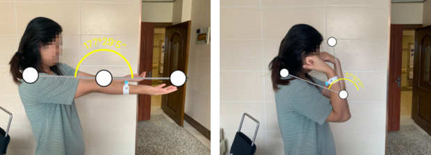 必威官方首页官网betway肘关节镜