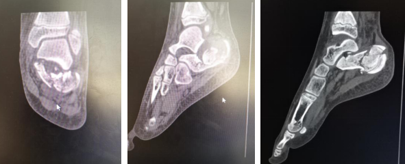 betway在线登陆足踝科