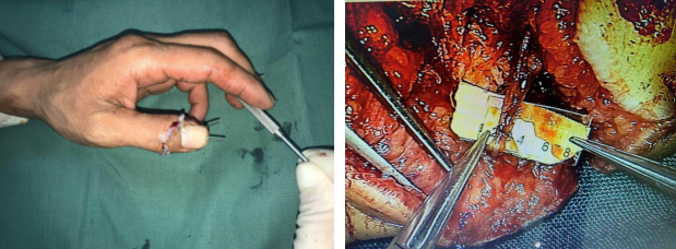 betway在线登陆手外科