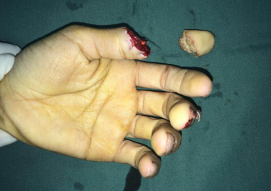 <a href='http://www.sararz.com/' target='_blank'><u>betway在线登陆</u></a>手外科