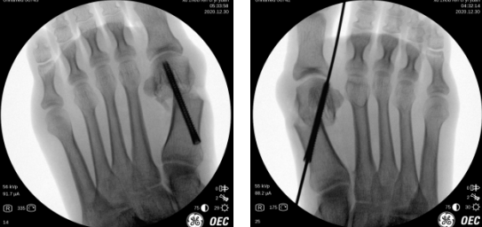 betway在线登陆足踝科