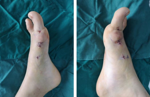 betway在线登陆足踝科