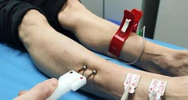 betway在线登陆周围神经外科