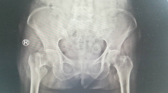 betway在线登陆关节科