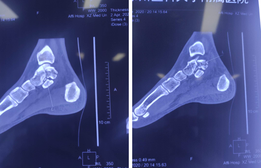 betway在线登陆足踝科