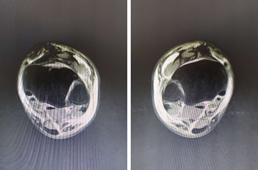 betway在线登陆足踝科