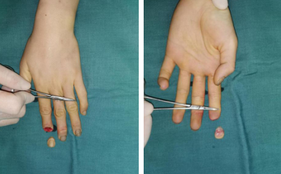 <a href='http://www.sararz.com/' target='_blank'><u>betway在线登陆</u></a>手外科