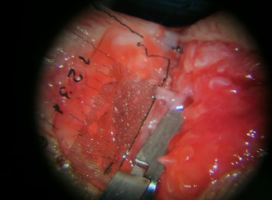 betway在线登陆手外科