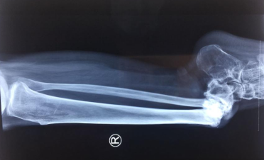 betway在线登陆足踝科