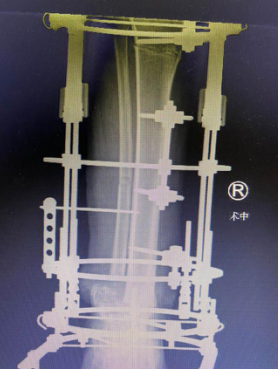 betway在线登陆足踝科