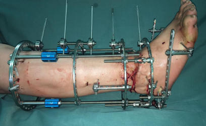 betway在线登陆足踝科