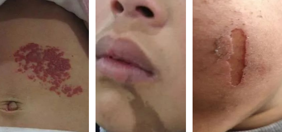 <a href='http://www.xzrcym.com/' target='_blank'><u>sararz医美</u></a>