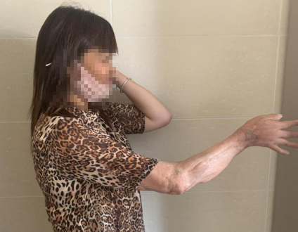 必威官方首页官网betway手外科