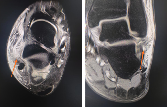 betway在线登陆足踝科
