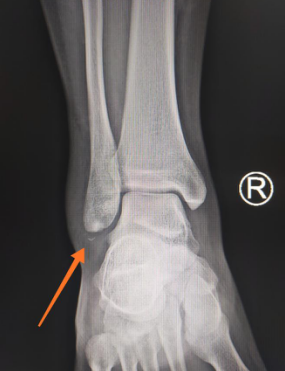 betway在线登陆足踝科