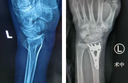 必威官方首页官网betway手外科